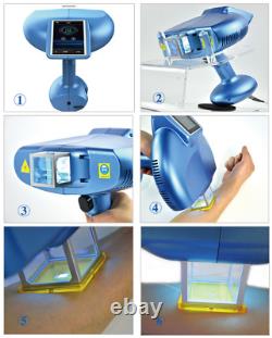 High-power 308nm Excimer System in dermatology phototherapy